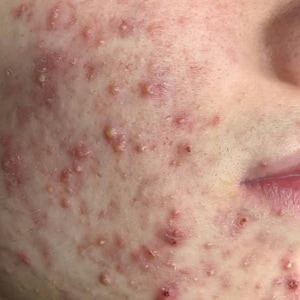 Elise added a photo of their purchase