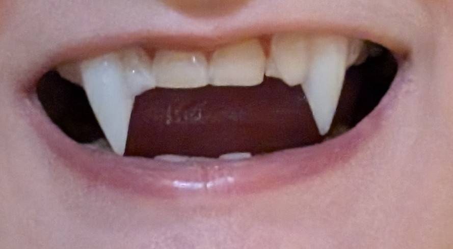 Reusable Fangs with Molding Kit for custom fit natural looking realistic cosplay anime vampire etc