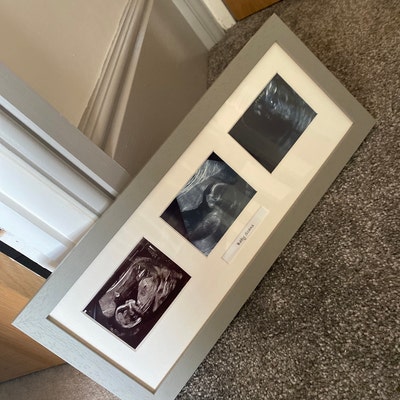 3 Aperture Photo Frame Baby Frame For Three Scan Photos Scan Photo Frame
