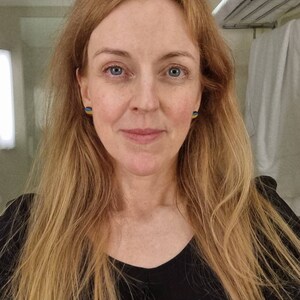 Cara lade till en bild av sitt köp