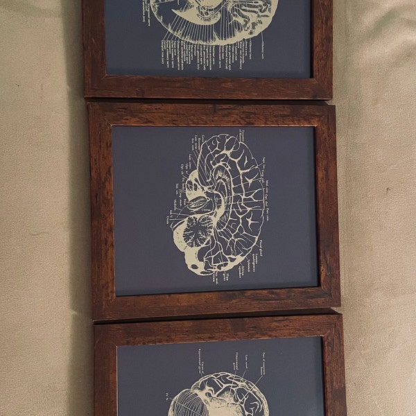 Brain Anatomy Art Foil Print Set of 3 - Medical School - Human Brain ...