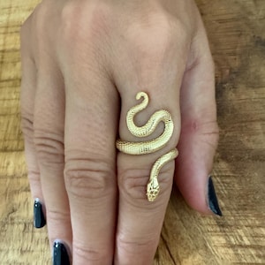Severin ha añadido una foto de su compra