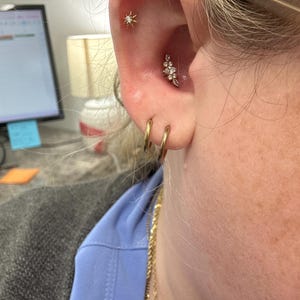 Suzanne added a photo of their purchase