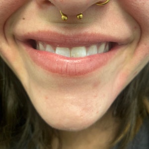 Alana added a photo of their purchase