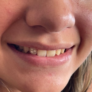 4Pcs Dental Teeth Gems Clear Crystal Tooth Gem Ornaments Jewelry N~C2