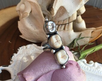 Triple Tooth Silver Capped tooth ooak