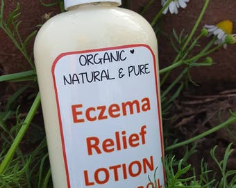 Eczema Lotion * Organic Eczema Relief Lotion full size, hemp oil, calendula infused shea butter, soothing oatmeal, seabuckthorn oil and more