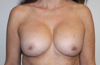Slender breasts