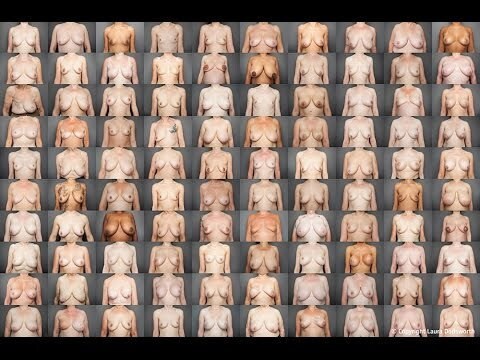 Breast collage