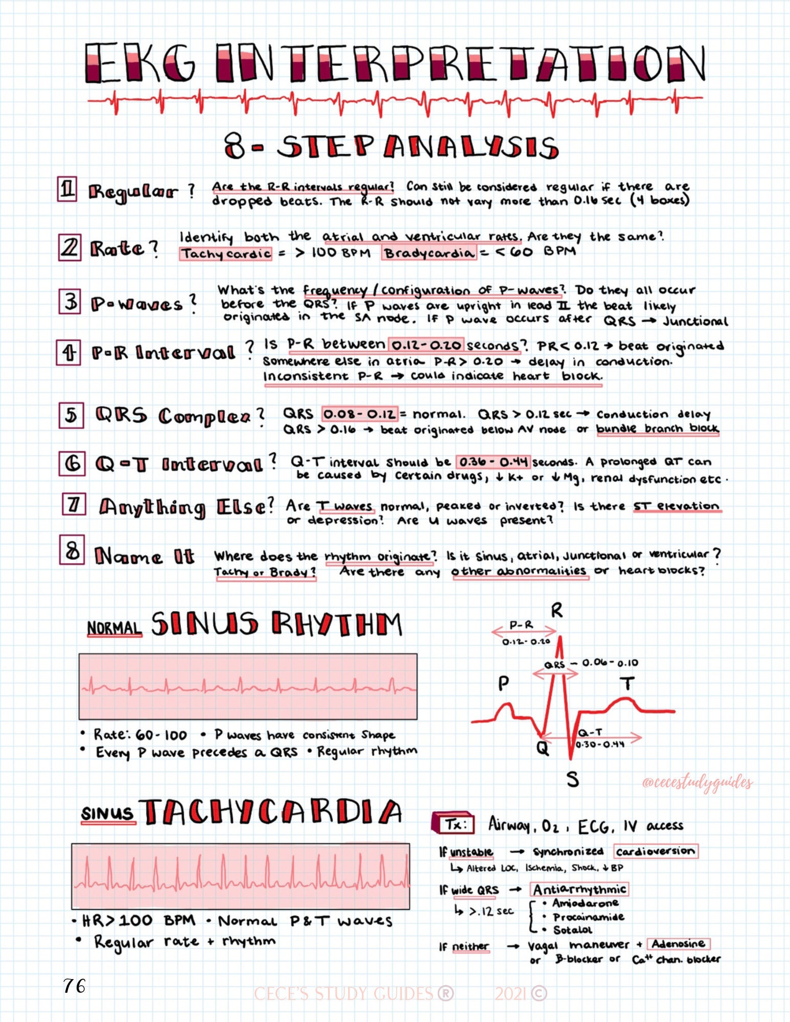 EKG interpretation in 8 easy steps with drawings