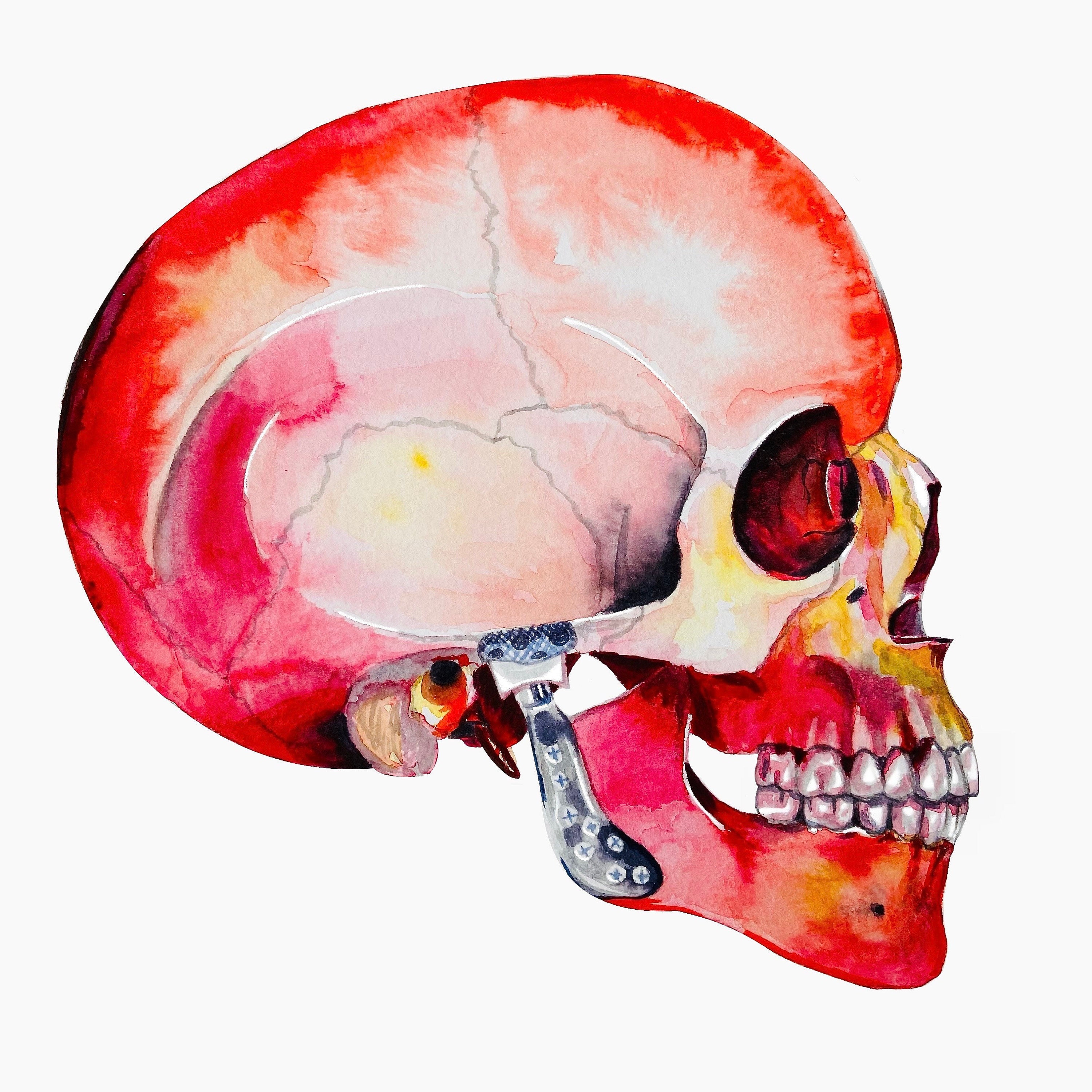 Oral Surgery Sticker Pack: Lefort/trauma 2 Stickers - Etsy Oral Surgery Sticker Pack: Lefort/trauma 2 Stickers - Etsy