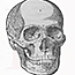 skeletos