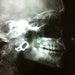 XrayVisionDesigns