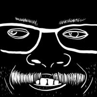FemurVision